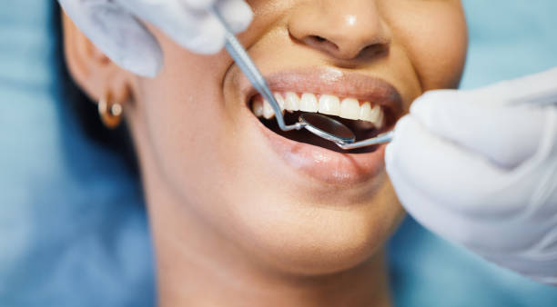 Best Emergency Treatment for Toothache in St Maries, ID