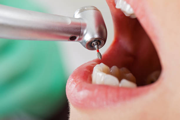 Best Emergency Dental Surgery in St Maries, ID